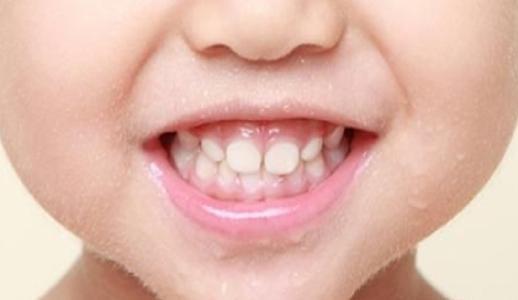 成人拔乳牙动画视频播放,成人拔乳牙全过程